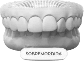dent1