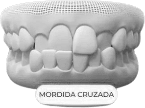 dent2