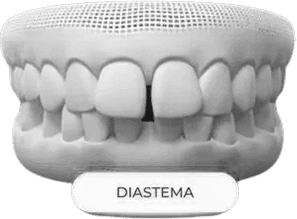 dent4