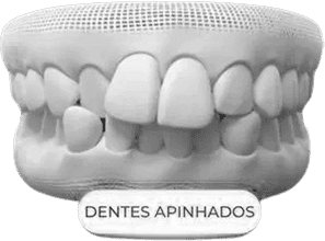 dent6